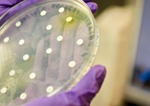 prostatitisaren diagnostikorako bakterioen kultura